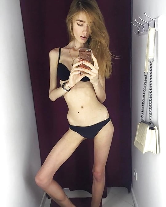 more skinny and anorexic girls 9